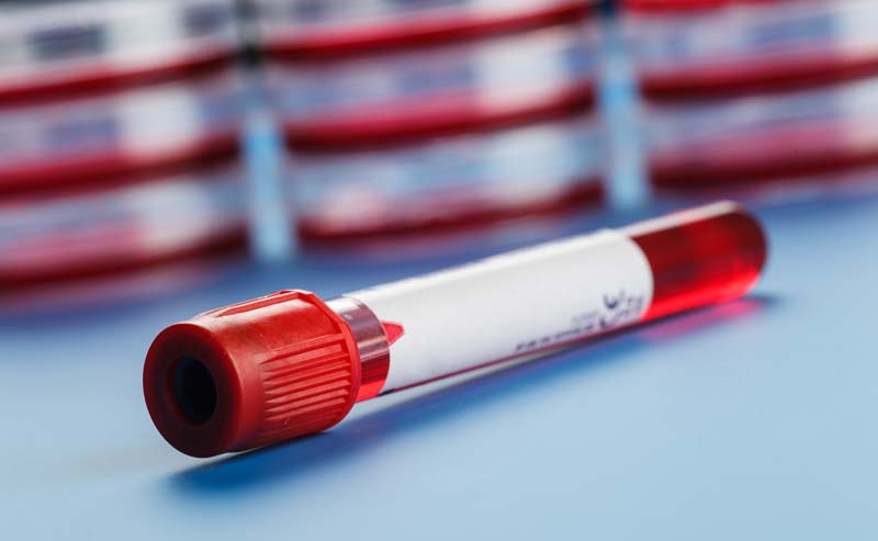 Ultrasonic Blood Collection Tube Coating Spraying