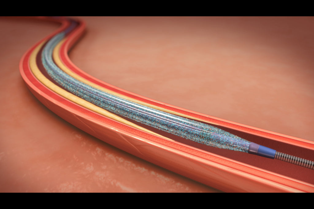 Ultrasonic Medical Balloon Catheter Spraying